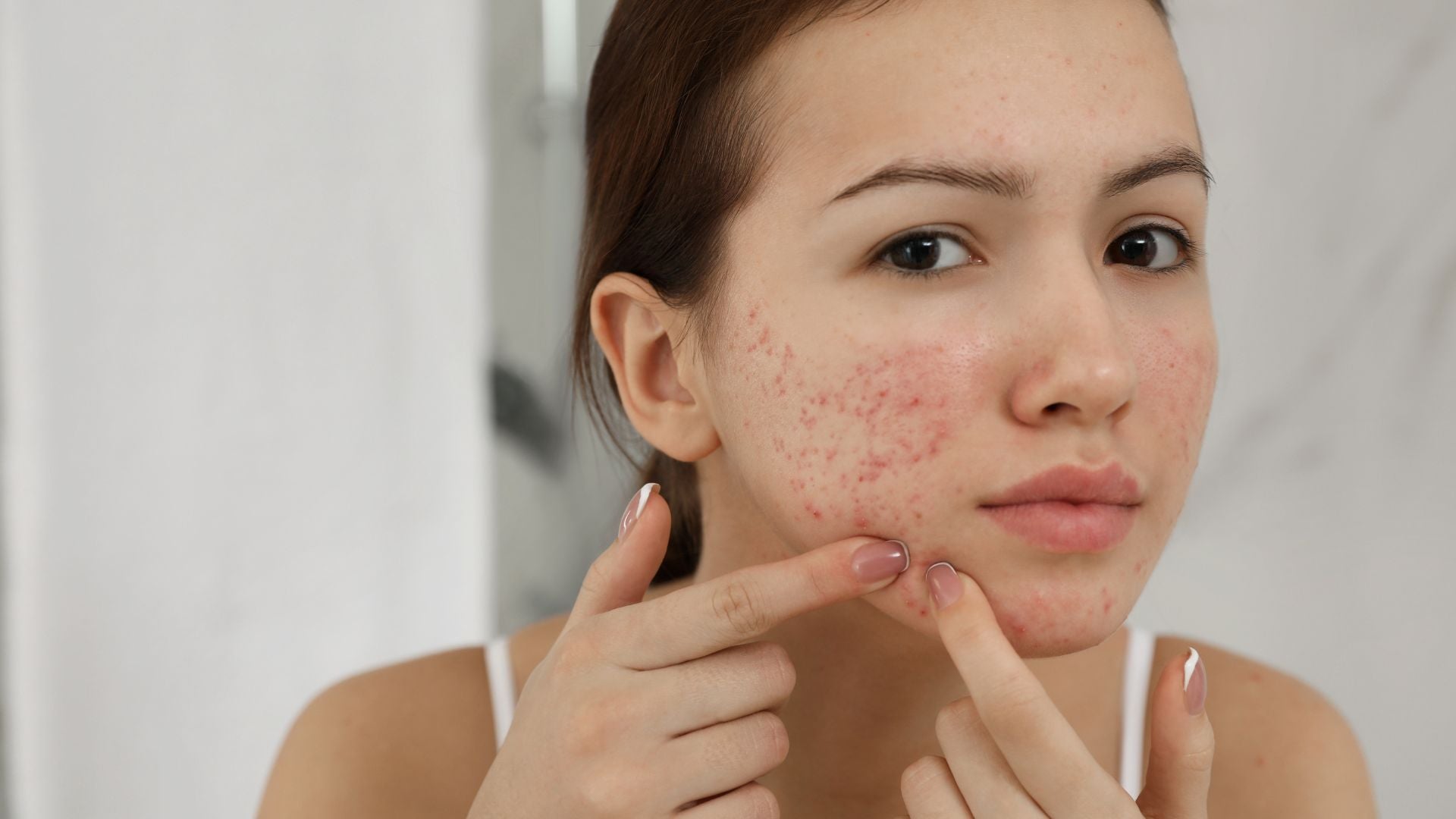 The Acne Pillowcase Predicament: Are You Sleeping on a Skin Nightmare?